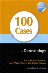 Book cover of 100 Cases in Dermatology by Rachael Morris-Jones