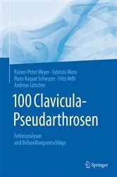 Book cover of 100 Clavicula-Pseudarthrosen by Rainer-Peter Meyer