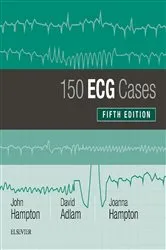 Book cover of 150 ECG Cases (5th ed.) by Hampton DM, MA, DPhil, FRCP, FFPM, FESC, John