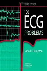 Book cover of 150 ECG Problems E-Book (3rd ed.) by Hampton DM, MA, DPhil, FRCP, FFPM, FESC, John