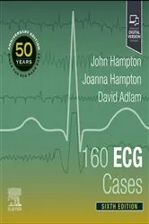 Book cover of 160 ECG Cases (6th ed.) by Hampton DM, MA, DPhil, FRCP, FFPM, FESC, John