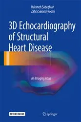 Book cover of 3D Echocardiography of Structural Heart Disease by Hakimeh Sadeghian