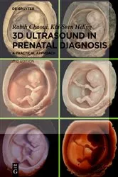 Book cover of 3D Ultrasound in Prenatal Diagnosis (2nd ed.) by Rabih Chaoui