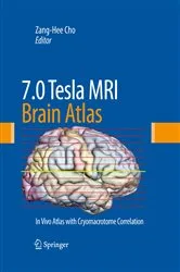 Book cover of 7.0 Tesla MRI Brain Atlas by Zang-Hee Cho