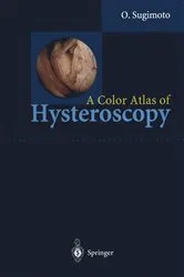 Book cover of A Color Atlas of Hysteroscopy by Osamu Sugimoto