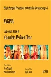 Book cover of A Colour Atlas of Complete Perineal Tear (Volume 4) by Unknown