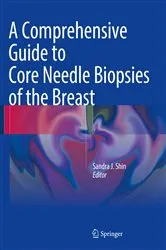 Book cover of A Comprehensive Guide to Core Needle Biopsies of the Breast by Sandra J. Shin