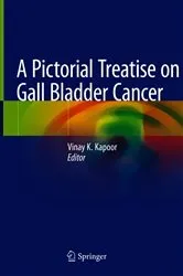 Book cover of A Pictorial Treatise on Gall Bladder Cancer by Vinay K Kapoor