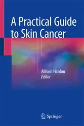 Book cover of A Practical Guide to Skin Cancer by Allison Hanlon