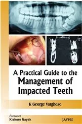 Book cover of A Practical Guide To The Management Of Impacted Teeth by K Varghese George