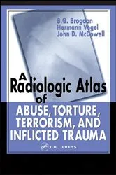 Book cover of A Radiologic Atlas of Abuse, Torture, Terrorism, and Inflicted Trauma by Unknown