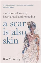 Book cover of A Scar is Also Skin by Ben Mckelvey