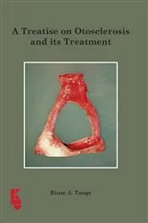 Book cover of A Treatise on Otoslerosis and its Treatment by R.A. Tange