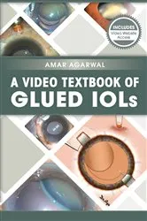 Book cover of A Video Textbook of Glued IOLs by Amar Agarwal