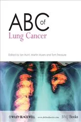 Book cover of ABC of Lung Cancer by Ian Hunt