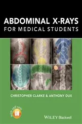 Book cover of Abdominal X-rays for Medical Students by Christopher Clarke