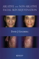 Book cover of Ablative and Non-ablative Facial Skin Rejuvenation by David J. Goldberg