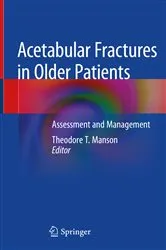 Book cover of Acetabular Fractures in Older Patients by Theodore T. Manson