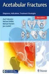 Book cover of Acetabular Fractures by Axel Gänsslen