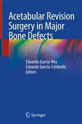 Book cover of Acetabular Revision Surgery in Major Bone Defects by Eduardo García-Rey