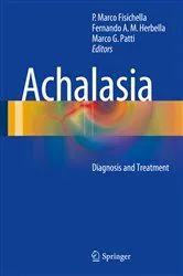 Book cover of Achalasia by P. Marco Fisichella
