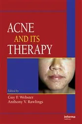 Book cover of Acne and Its Therapy by Guy F. Webster