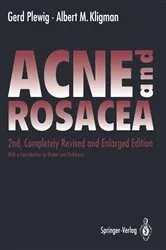 Book cover of ACNE and ROSACEA (2nd ed.) by C. Bluhm