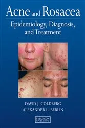 Book cover of Acne and Rosacea by Alison Bowser