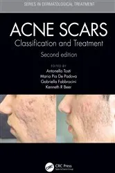 Book cover of Acne Scars (2nd ed.) by Antonell Tosti