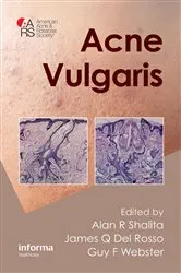 Book cover of Acne Vulgaris by Alan R. Shalita
