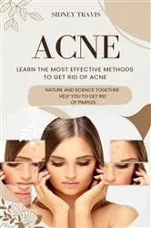 Book cover of Acne by Unknown