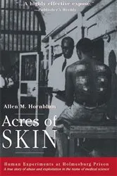 Book cover of Acres of Skin by Allen M. Hornblum