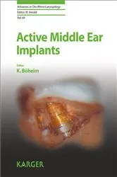 Book cover of Active Middle Ear Implants by K. Böheim