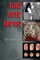 Book cover of Acute Aortic Disease by John Elefteriades