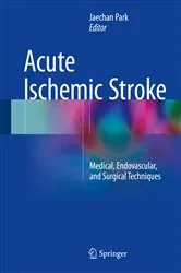 Book cover of Acute Ischemic Stroke by Jaechan Park