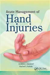 Book cover of Acute Management of Hand Injuries by Andrew Weiland