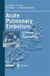 Book cover of Acute Pulmonary Embolism by Unknown