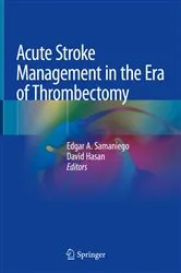 Book cover of Acute Stroke Management in the Era of Thrombectomy by Edgar A. Samaniego