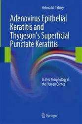 Book cover of Adenovirus Epithelial Keratitis and Thygeson's Superficial Punctate Keratitis by Helena M. Tabery