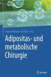 Book cover of Adipositas- und metabolische Chirurgie by Jürgen Ordemann