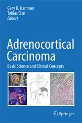 Book cover of Adrenocortical Carcinoma by Gary D. Hammer