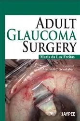 Book cover of Adult Glaucoma Surgery by Freitas Maria da Luz