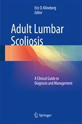 Book cover of Adult Lumbar Scoliosis by Eric O. Klineberg