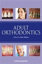 Book cover of Adult Orthodontics by Unknown