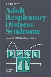 Book cover of Adult Respiratory Distress Syndrome by J.A. Sturm