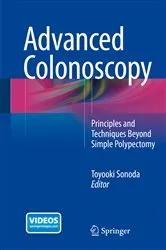 Book cover of Advanced Colonoscopy by Toyooki Sonoda