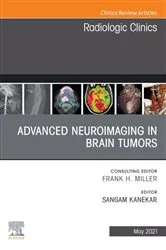 Book cover of Advanced Neuroimaging in Brain Tumors, An Issue of Radiologic Clinics of North America, E-Book by Sangam Kanekar MD