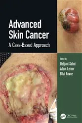 Book cover of Advanced Skin Cancer by Debjani Sahni