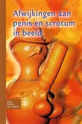 Book cover of Afwijkingen aan penis en scrotum in beeld by H. H. J. Leliefeld