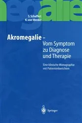 Book cover of Akromegalie — Vom Symptom zu Diagnose und Therapie by S. Schaffert